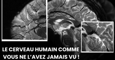 images incroyables du cerveau