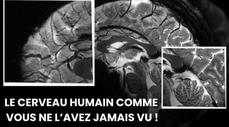 images incroyables du cerveau